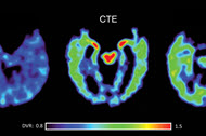 Medical Terminology - New Term CTE
